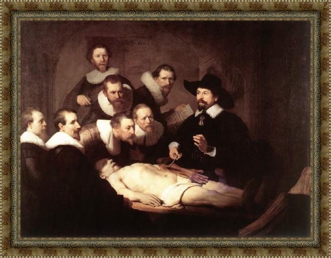Framed Rembrandt the anatomy lecture of dr tulp painting